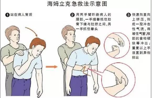 成人疝气带穿戴方法视频,成人疝气带穿戴步骤详解