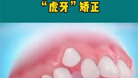 成人脱牙的正确方法视频,成人脱牙操作步骤详解